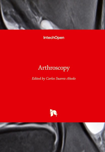 Carlos Suarez-Ahedo | Arthroscopy | Buch | Englisch (2022) | Gebunden-image