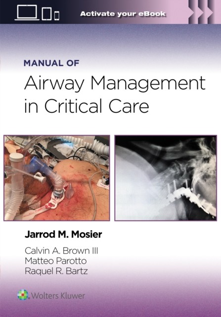 Manual of Airway Management in Critical  by III, MD Brown Calvin A PAPERBACK