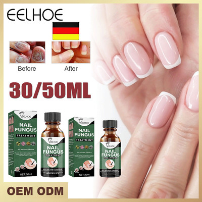 50ml / 30ml Nail Fungus Treatment Best Nail Repair Effective Anti Fungal NEU DE