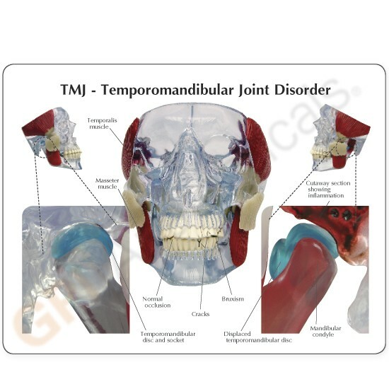 TMJ - Giunto temporo-mandibolare modello anatomico GPI LFA #2880 VIDEO Fai un'offerta! foto 4