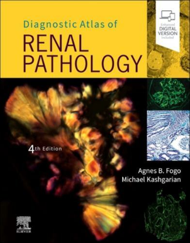 Diagnostic Atlas of Renal Pathology by Agnes B. Fogo, Michael... - 9780323721639 - Image 2
