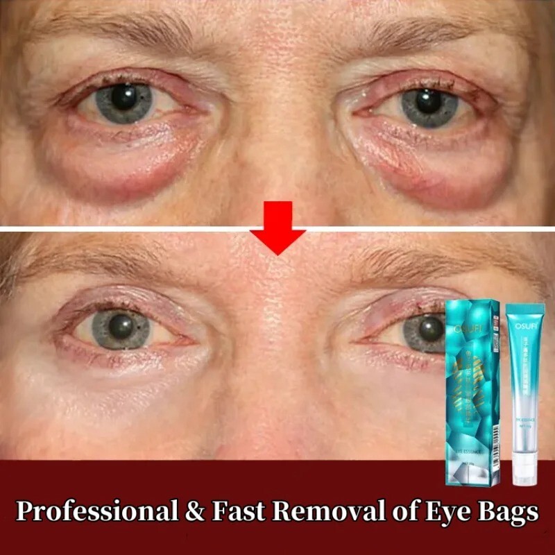 7 Days Anti-Wrinkle Magic Eye Cream Remove Eye Bags Dark Circles