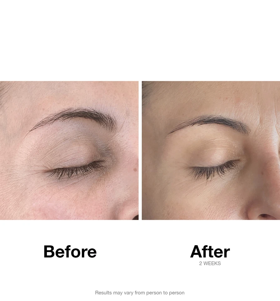 Marine Essence-Nourishing Eye Cream-Dark Circles-Wrinkles-US Patented Technology - Image 4 of 4