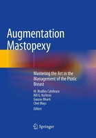 Augmentation Mastopexy Mastering The Art In The Management Of The Ptotic Breast