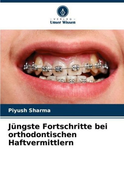 JüNgste Fortschritte Bei Orthodontischen Haftvermittlern Piyush Sharma-image