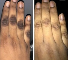 Dark knuckle Skin Whitening lightening Kojic acid, Glycolic acid, Fade CREAM