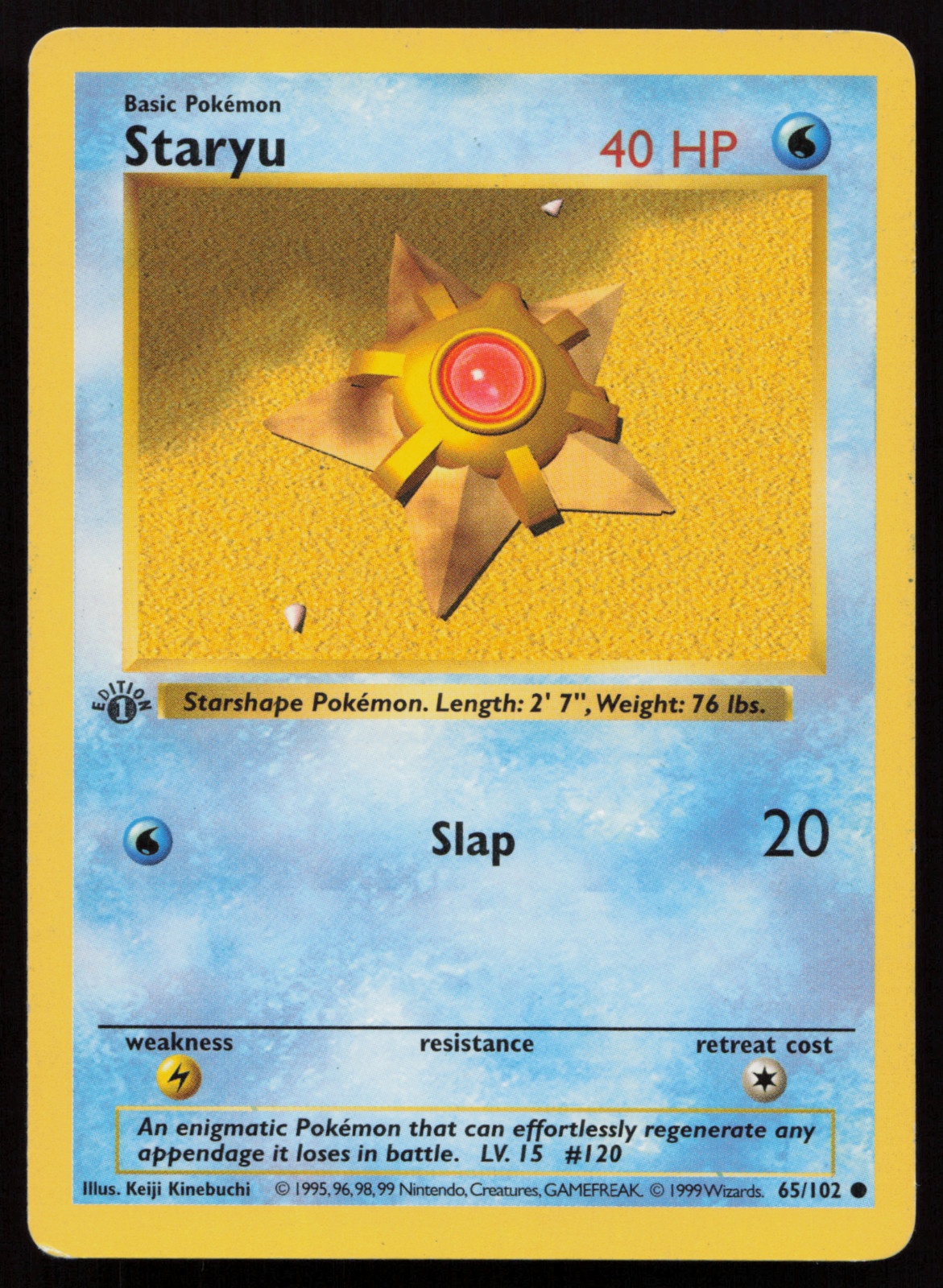 ⭐1st Edition Shadowless Staryu 65/102 Base Set Pokemon Card WOTC 1999 LP