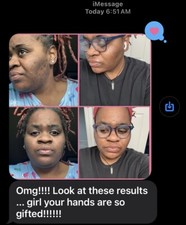 Turmeric and Kojic Acid Soap Bar/2 Pack