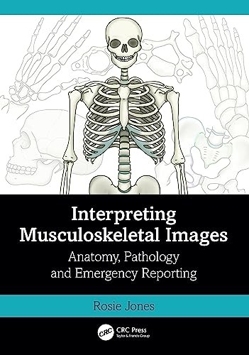 Interpreting Musculoskeletal Images : Anatomy, Pathology and Emergency Reporting - Image 8