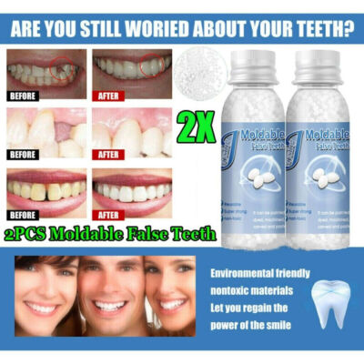 2Pcs Tooth Repair Granules Temporary Fitting Beads Reusable Moldable False Teeth