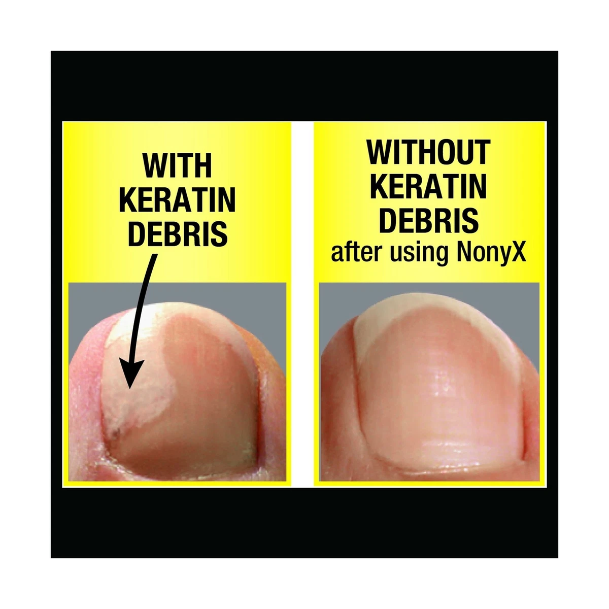 Aggregate 134+ debris under nail ceg.edu.vn