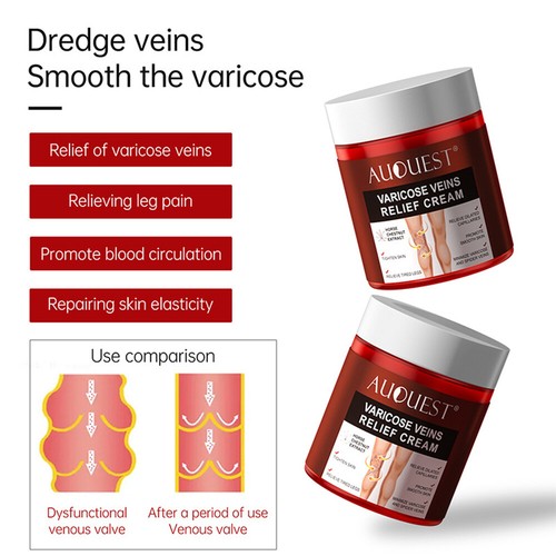 2X Crema de alivio de venas varicosas vasculitis flebitis araña alivio del dolor Ungüento - Imagen 6 de 21