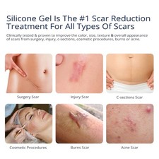 Scar Gel 2 Pack - Silicone Treatment for Scars