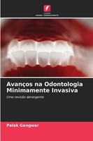 AvançOs Na Odontologia Minimamente Invasiva Palak Gangwar