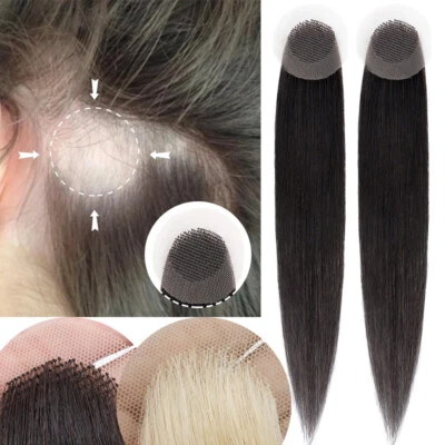 SEGO Damen/Männer Haarpflaster vorderen Haaransatz Toupet für kahle Stellen Echthaar