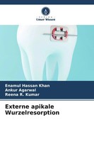 Enamul Hassan Khan (U. A.) | Externe Apikale Wurzelresorption | Taschenbuch