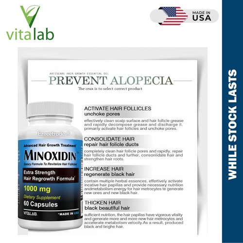 MINOXIDINA 1000mg Crecimiento del Cabello 120 Comprimidos Extra Fuerza Hombres Mujeres Recrecimiento EE. UU. - Imagen 4 de 21