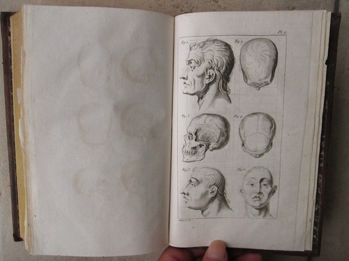 PINEL : TRAITE MEDICO-PHILOSOPHIQUE SUR L'ALIENATION MENTALE, 1809. - Picture 18 of 24