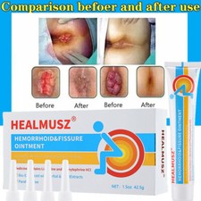 Hemorrhoids Remove Ointment Herbal Cream Fast Relief Piles Pain Reduce Itching