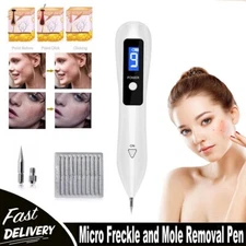 Electric Laser Plasma Pen Freckle Removal Dark Spot Remover Skin Tag Tattoo Tool