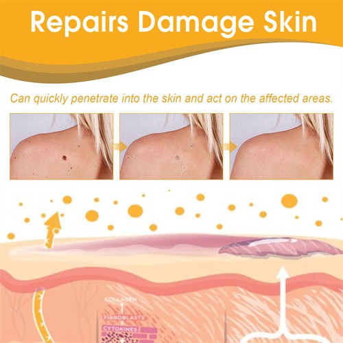 Tag Recede Bee Venom Treatment Spray,Tag Recede,Bee Venom Spray for All Skin New - Picture 6 of 13