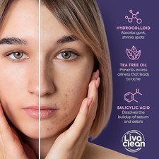 LivaClean Star Pimple Patches for Face w/Hydrocolloid, Salicylic Acid TeaTree