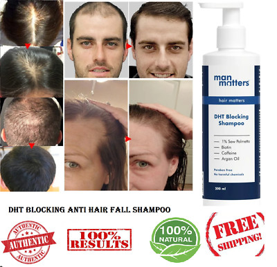 DHT Blocking Anti Hair Fall Shampoo 200ml Biotin, Caffeine & Argan Oil