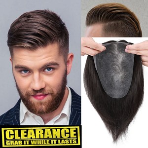 toupee hair replacement system