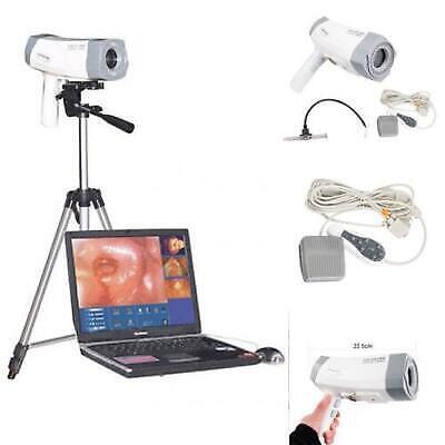 Carejoy Sony Camera Electronic Colposcope 480k Pixels Software With Tripod 
