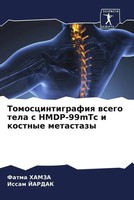 Fatma Hamza (U. A.) | Tomoscintigrafiq Wsego Tela S Hmdp-99Mtc I Kostnye...