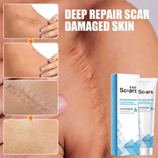Scar Removal Cream 20g   Stretch Marks, Burns, Scald, Repair  Cesarean Care