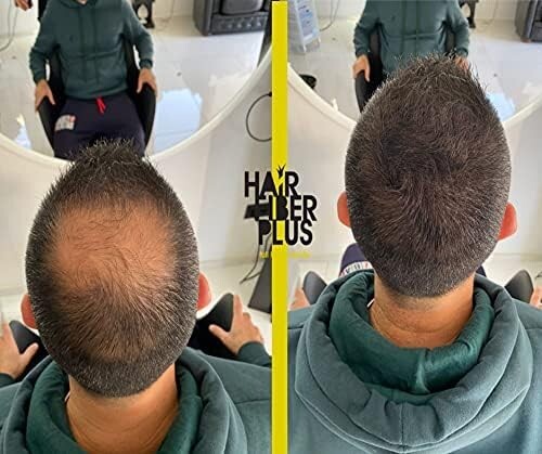 Hair Fiber Plus, fibre copri calvizie istantaneo in pochi secondi - Imagen 4 de 25