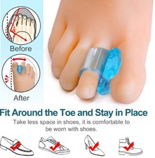 1 Pair Silicone Gel Bunion Corrector Toe Separator Orthotic Pain Relief Spacer
