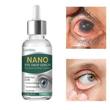 1-5 Nano Eye Drops Serum,Natural Nano Lubricant Eye Drops for Dry Eye Presbyopia
