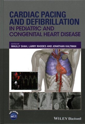 Cardiac Pacing and Defibrillation in Pediatric and Congenital Heart Disease, ...