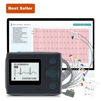 12 Lead Holter Monitor Recording 24h ECG and Heart Rate AI Analysis Abnormal ECG