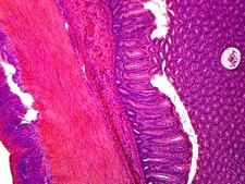 Colon, Human; Showing Typical Histology Structures; Cross Section