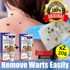 100 Skin Tag Mole Wart Removal ORIGINAL 20G