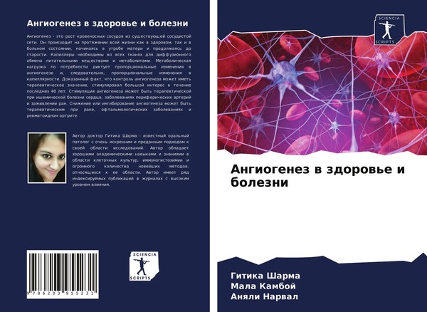 Gitika Sharma (U. A.) | Angiogenez W Zdorow'e I Bolezni | Taschenbuch | Russisch-image