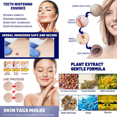 US 2 Pack Wart Skin Remover Cream Antibacterial Extract Corn Plaster Ointment