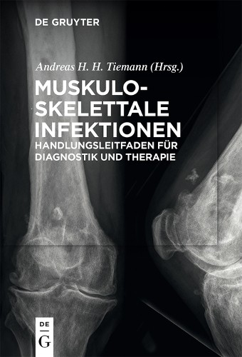 Andreas Heinrich Tiemann Muskuloskelettale Infektionen (Taschenbuch) (US IMPORT) - Bild 1 von 1