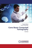 Priyanka Nikose (U. A.) | Cone Beam Computed Tomography | Taschenbuch | Englisch