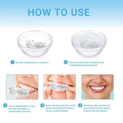 Dream Mouth Guard Custom Anti Snoring Device Mouthpiece Sleeping Aids Stop Snore - Picture 5 of 12
