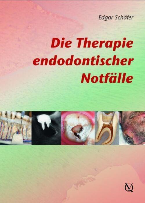Thumbnail - Die Therapie Endodontischer Notfälle Edgar Schäfer Buch 220 S. Deutsch
