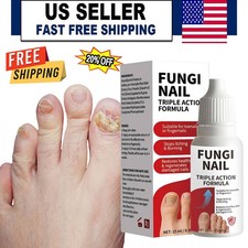 Fungi Nail Anti-Fungal Liquid Herbal Extracts Toenail Fungus Treatment Safe Us