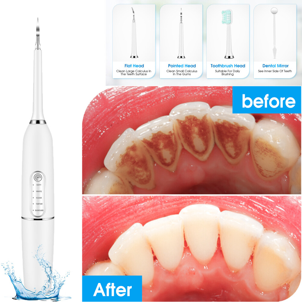 Ultrasonic Tooth Cleaner Dental Scaler Remove Plaque Tartar 