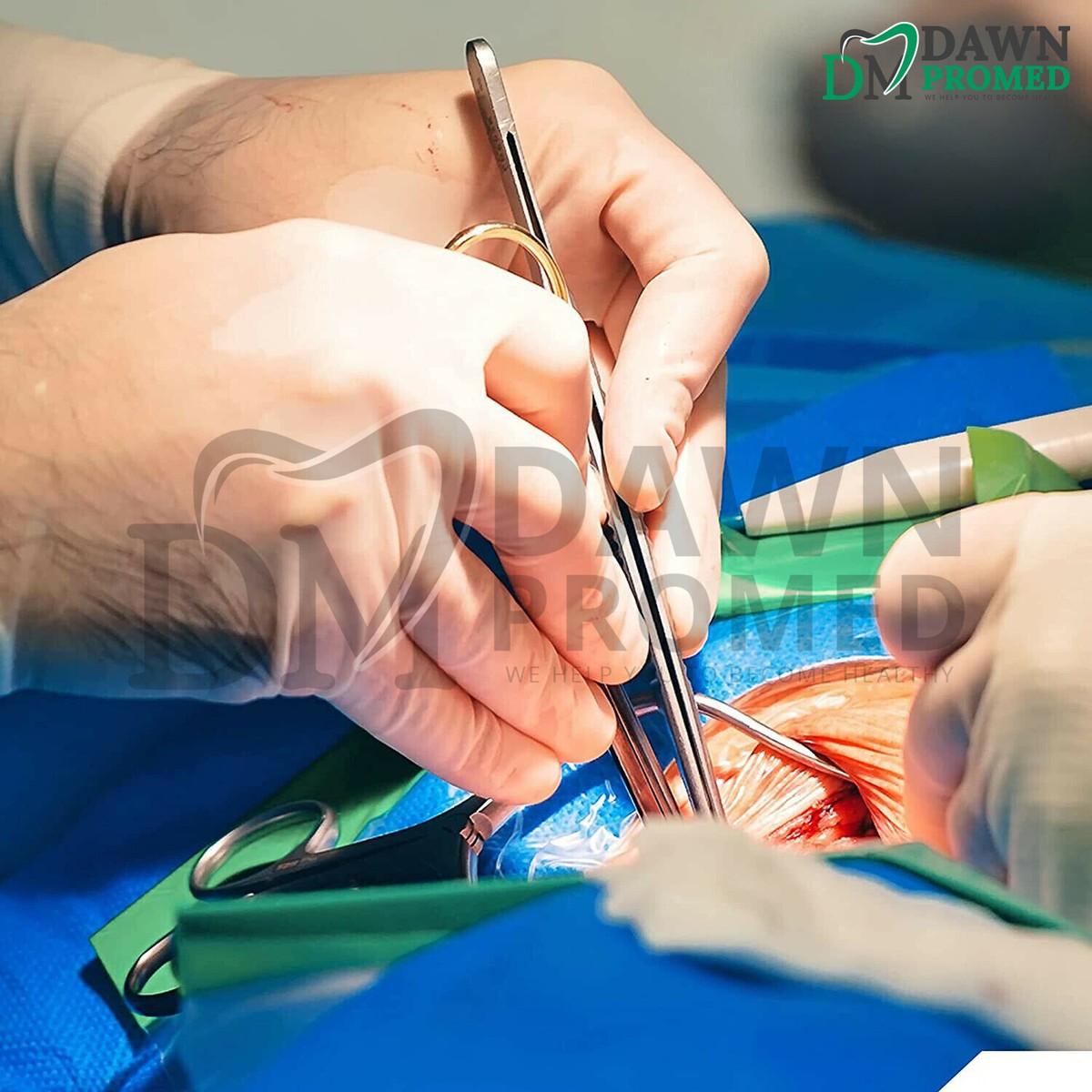 Lame Per Estetista Dentista 50 Lame Chirurgiche Sterili #10 E #11 - Per Manico Bisturi #3, Alta Qualità Professionale Lame #10 #11 - Foto 11