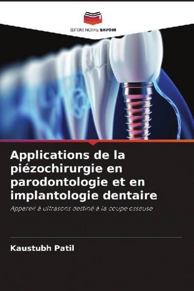 Applications De La PiéZochirurgie En Parodontologie Et En Implantologie Dentaire-image