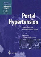 Plinio Rossi | Portal Hypertension | Taschenbuch | Englisch (2013) | X