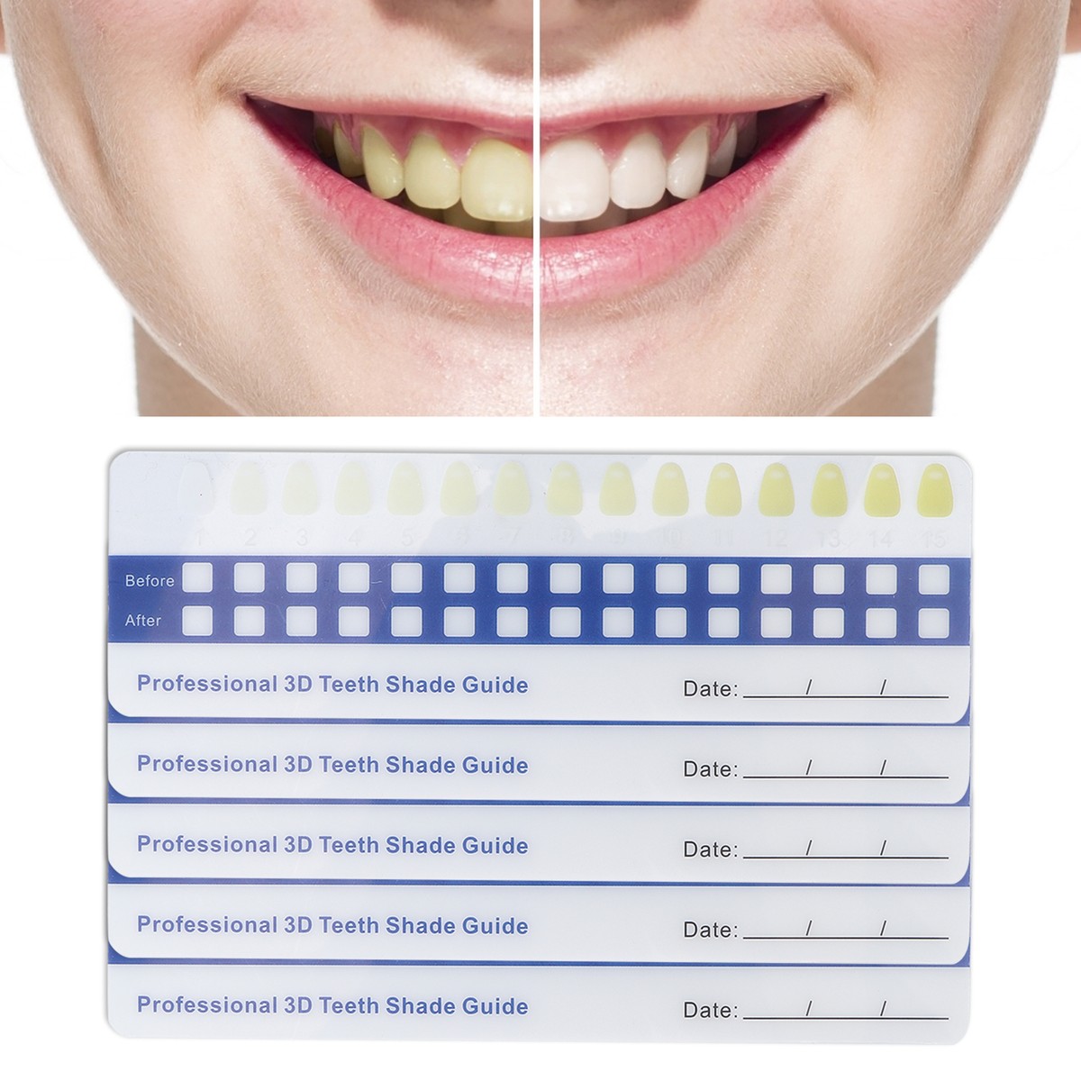 Teeth Color Shades Chart New Tampa Dentist Breaks Down The Leading